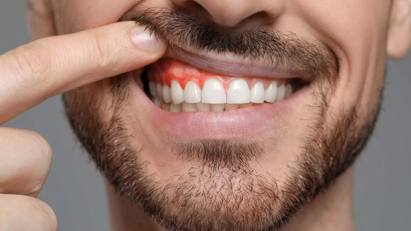 Periodontics